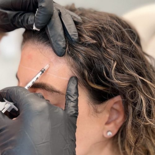 Botox
